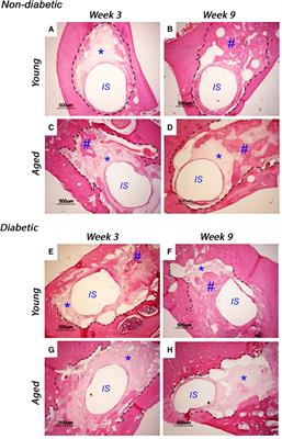 Hyperglycemia exerts disruptive effects on the secretion of TGF-β1 and its matrix ligands, decorin and biglycan, by mesenchymal sub-populations and macrophages during bone repair
